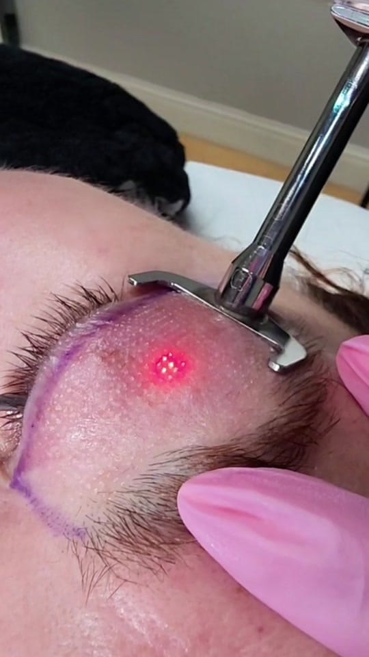 Post 3 by Eterna Cosmetic Surgery on TikTok (video)
