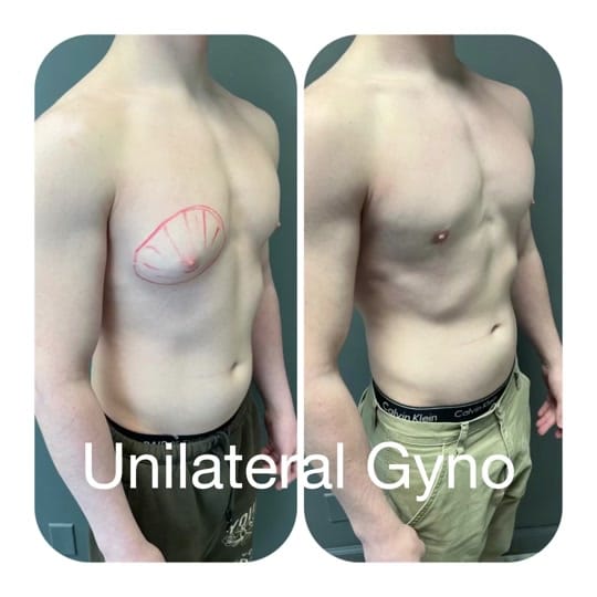 Post 3 by Dr Mordcai Blau/Gyno on TikTok (video)