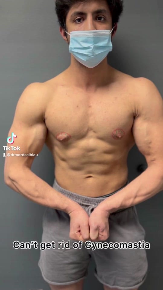 Post 9 by Dr Mordcai Blau/Gyno on TikTok (video)