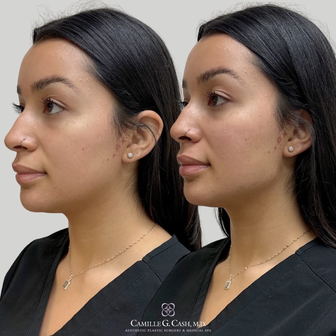 Post 8 by Camille Cash MD on TikTok (video)