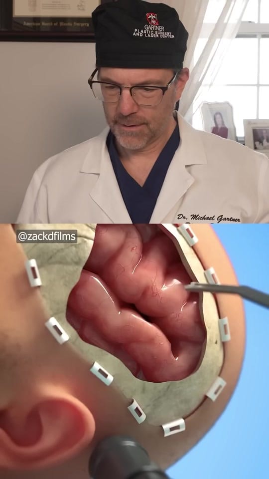 Post 2 by Dr. Michael Gartner on TikTok (video)