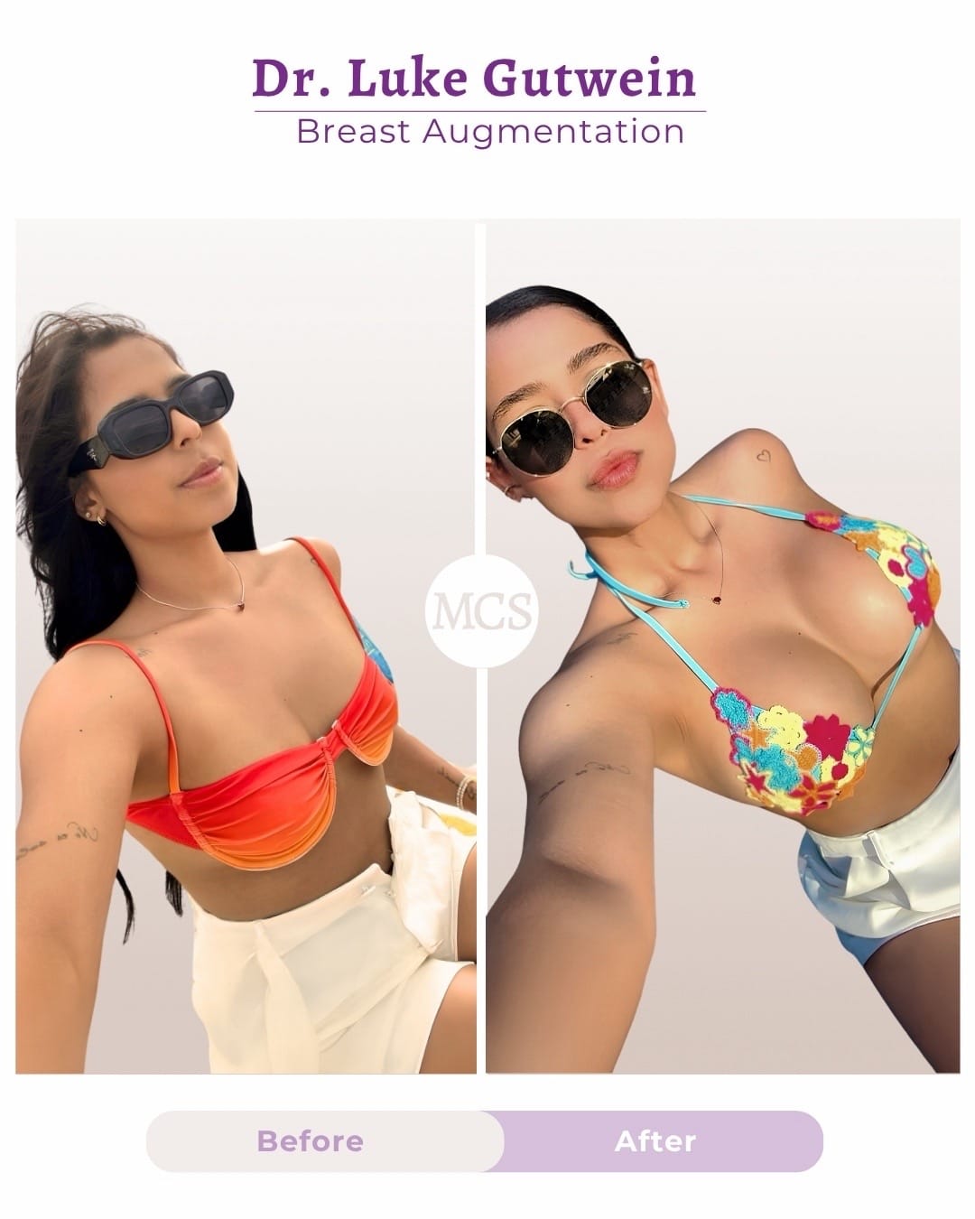 Post 4 by My Cosmetic Surgery on TikTok (video)