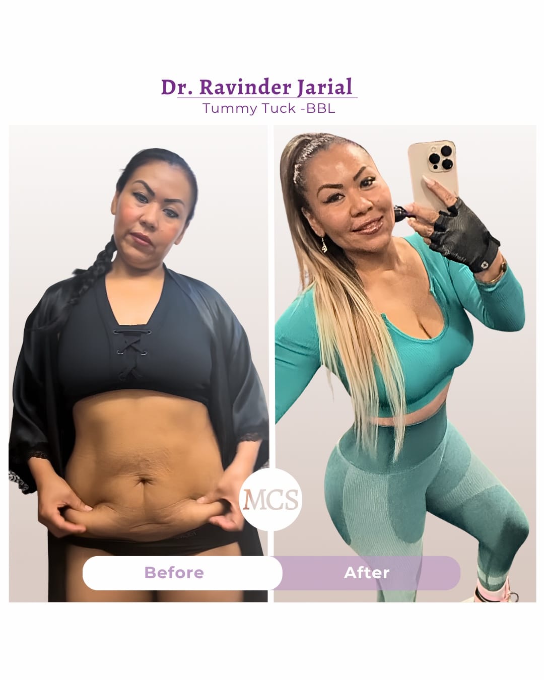Post 2 by My Cosmetic Surgery on TikTok (video)