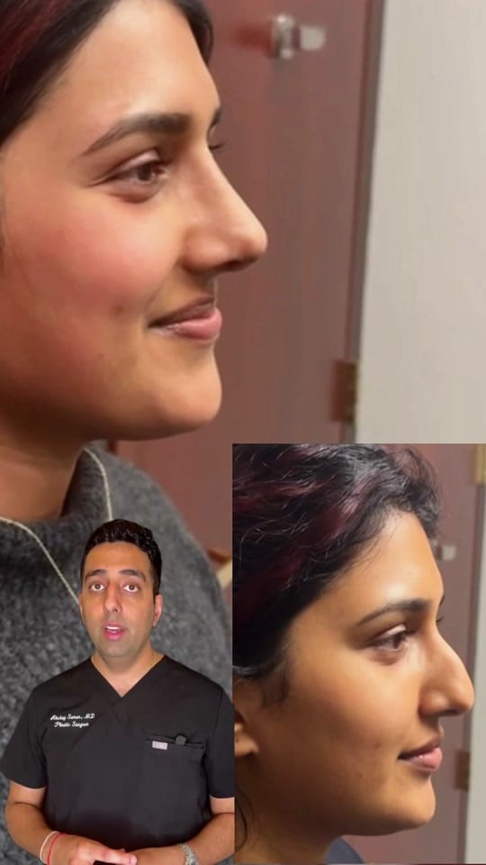 Post 7 by Dr. Sanan | Plastic Surgeon on TikTok (video)