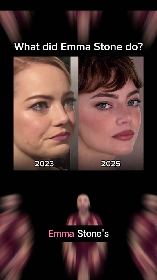 Post 8 by Dr. Jarrett Schanzer on TikTok (video)