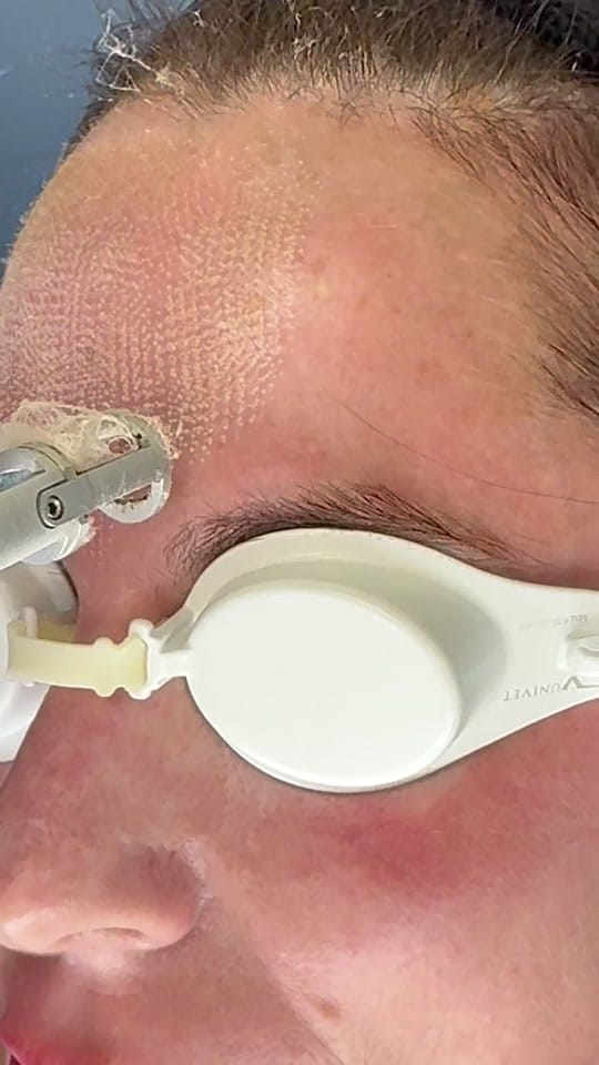 Post 5 by Dr. Jarrett Schanzer on TikTok (video)