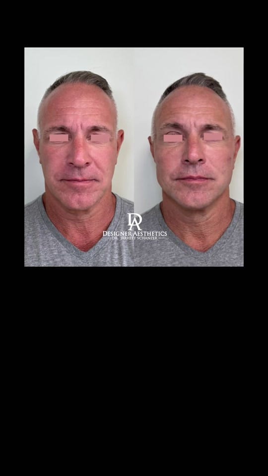 Post 6 by Dr. Jarrett Schanzer on TikTok (video)