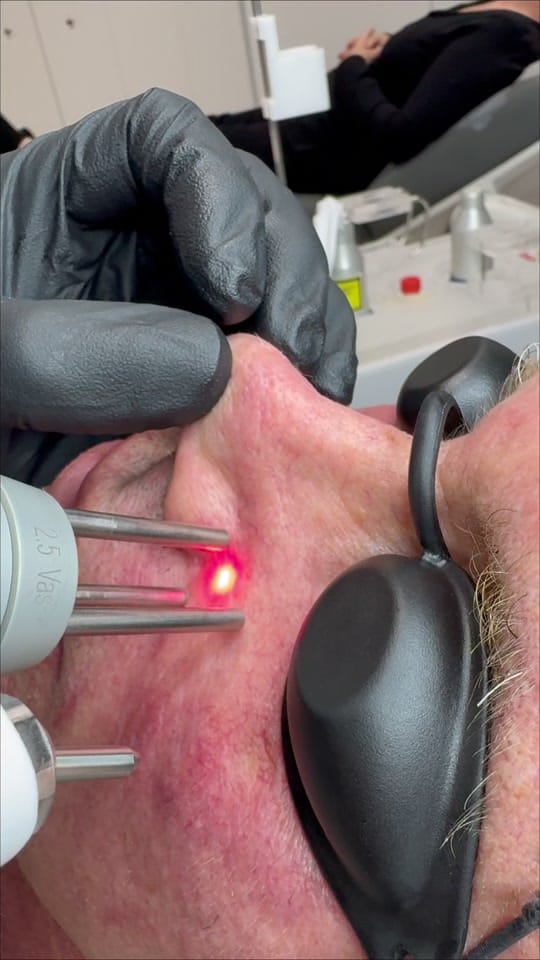 Post 1 by Dr. Jarrett Schanzer on TikTok (video)