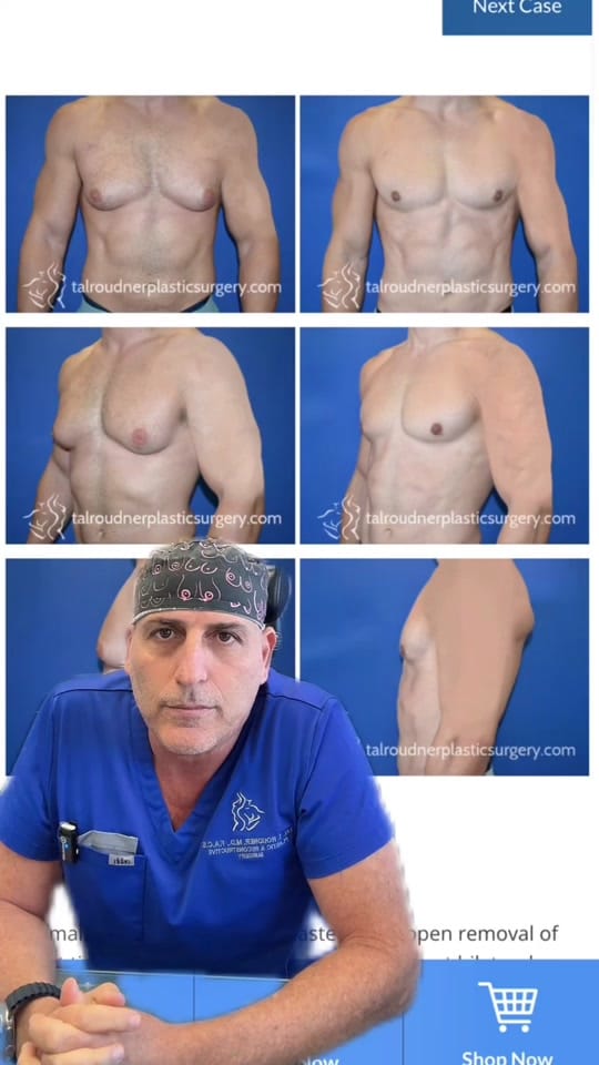 Post 8 by Dr Tal Roudner Plastic Surgery on TikTok (video)