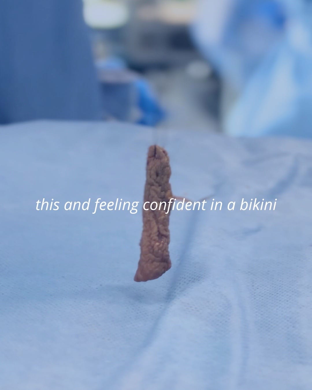 Post 2 by Dr Tal Roudner Plastic Surgery on TikTok (video)