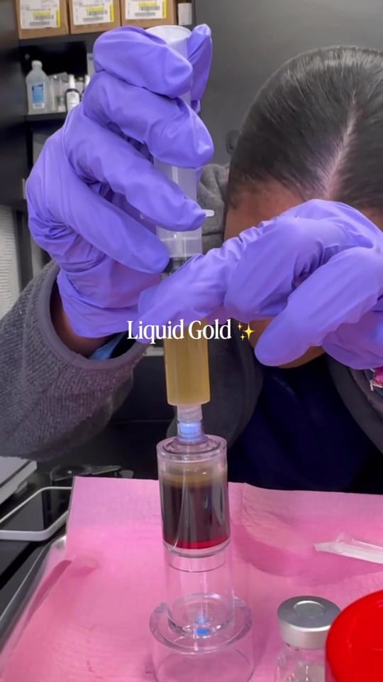 Post 10 by Dr. Sharon Aesthetics | HTX on TikTok (video)
