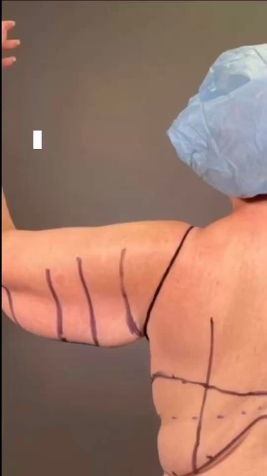 Post 3 by The Glow Plastic Surgery on TikTok (video)