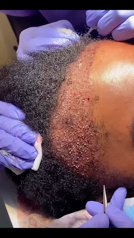Post 10 by The Glow Plastic Surgery on TikTok (video)