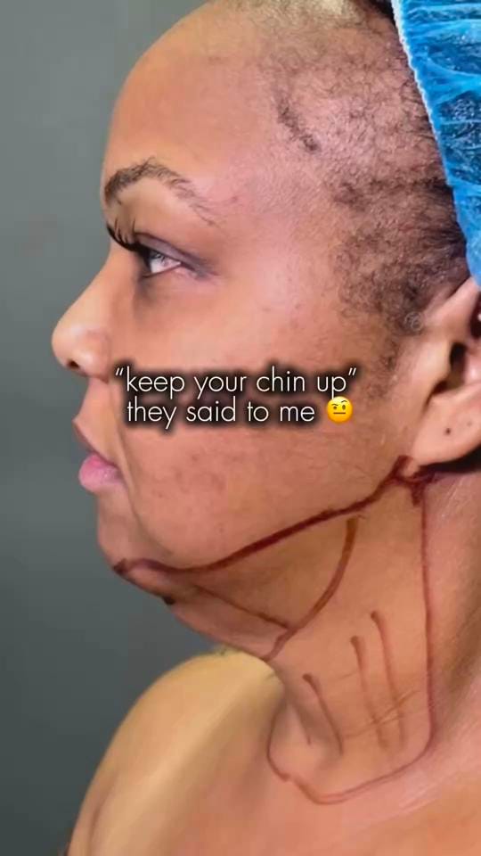 Post 2 by The Glow Plastic Surgery on TikTok (video)
