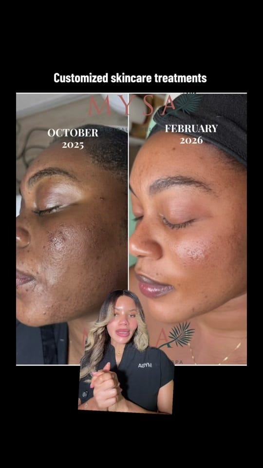 Post 5 by Mysa Medical & Wellness Spa on TikTok (video)