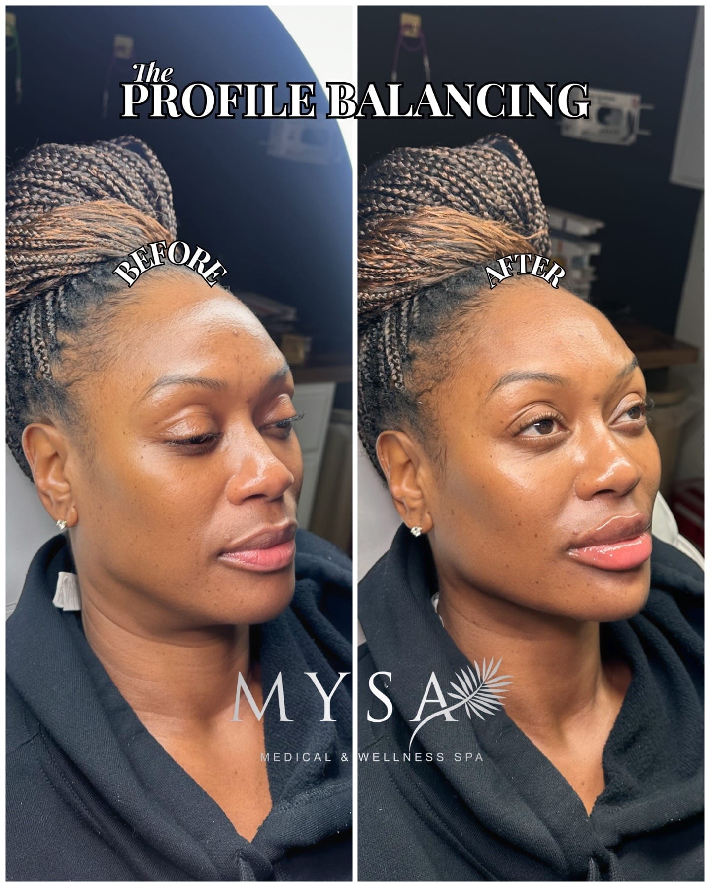 Post 9 by Mysa Medical & Wellness Spa on TikTok (video)