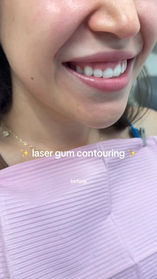 Post 8 by Dr. Tasneem - Gloss Dentistry on TikTok (video)