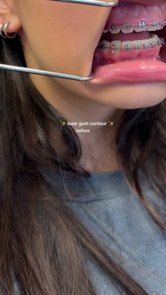 Post 4 by Dr. Tasneem - Gloss Dentistry on TikTok (video)
