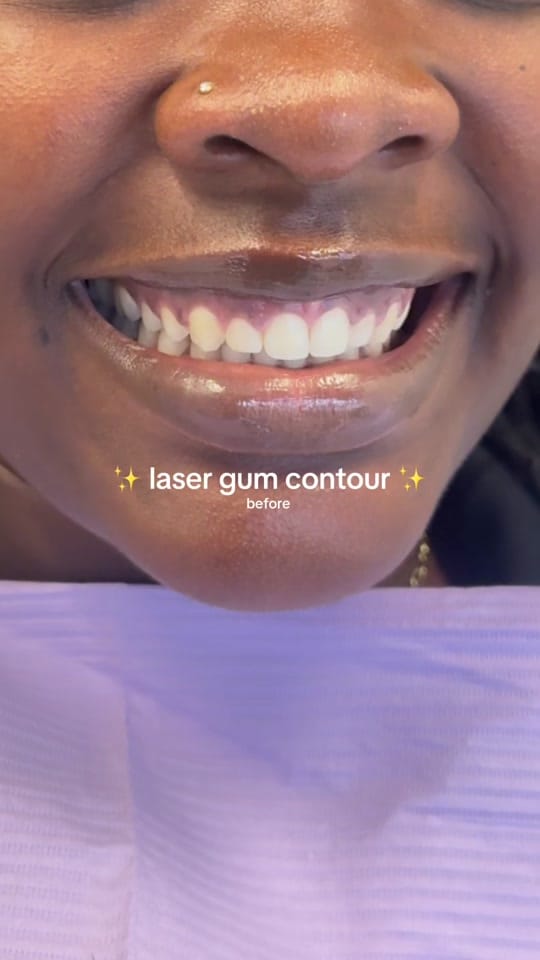 Post 1 by Dr. Tasneem - Gloss Dentistry on TikTok (video)