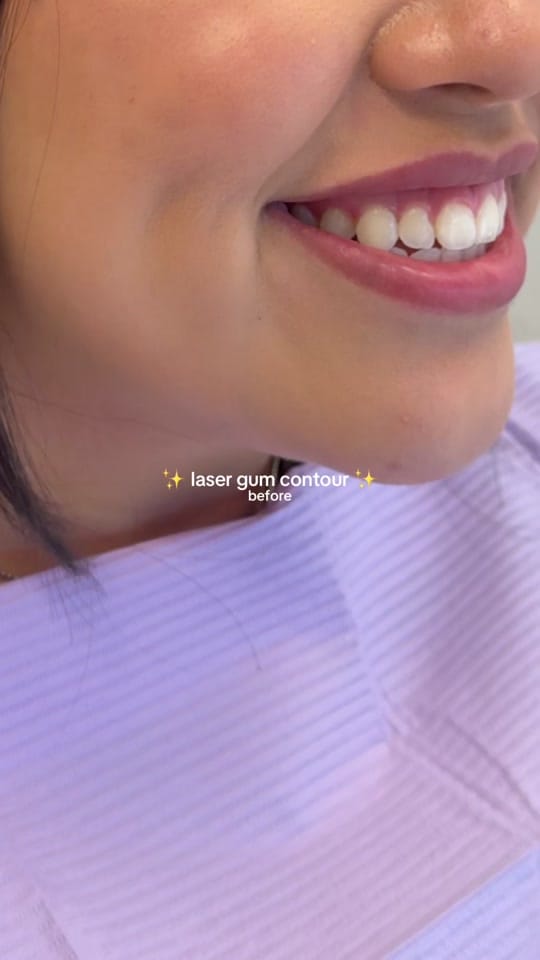 Post 2 by Dr. Tasneem - Gloss Dentistry on TikTok (video)
