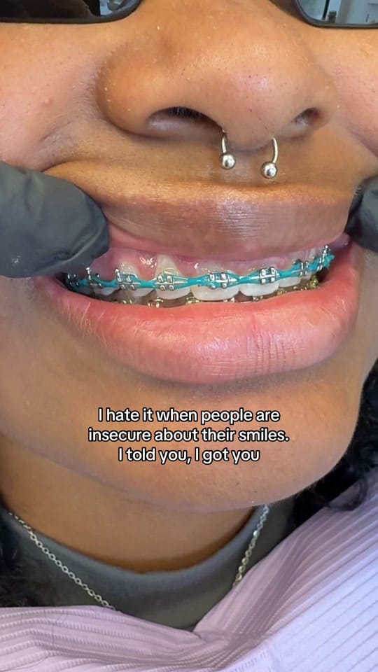 Post 10 by Dr. Tasneem - Gloss Dentistry on TikTok (video)