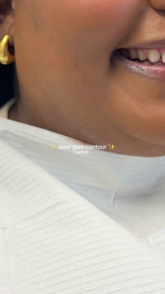 Post 6 by Dr. Tasneem - Gloss Dentistry on TikTok (video)