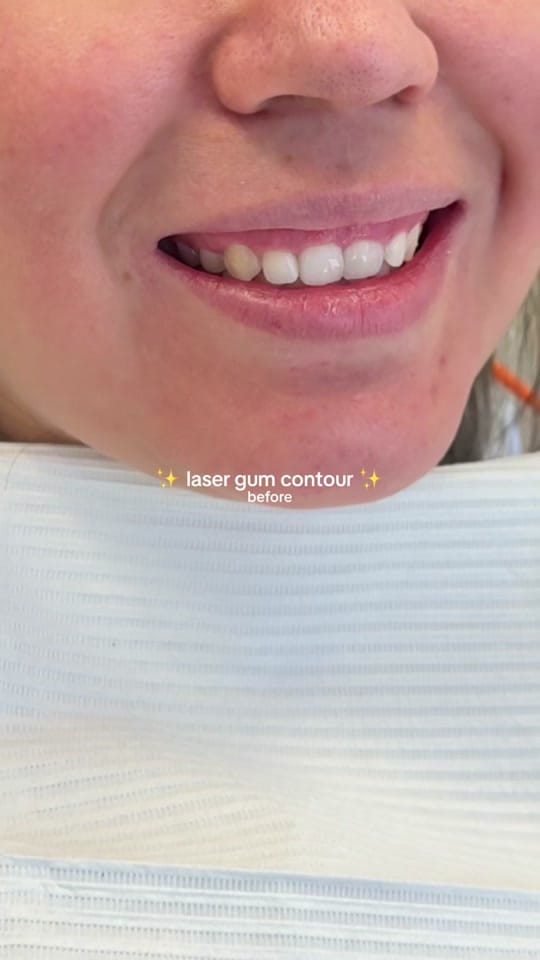 Post 7 by Dr. Tasneem - Gloss Dentistry on TikTok (video)
