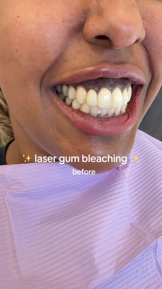 Post 9 by Dr. Tasneem - Gloss Dentistry on TikTok (video)