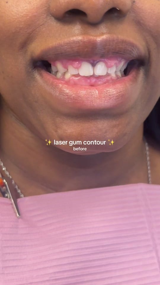Post 5 by Dr. Tasneem - Gloss Dentistry on TikTok (video)