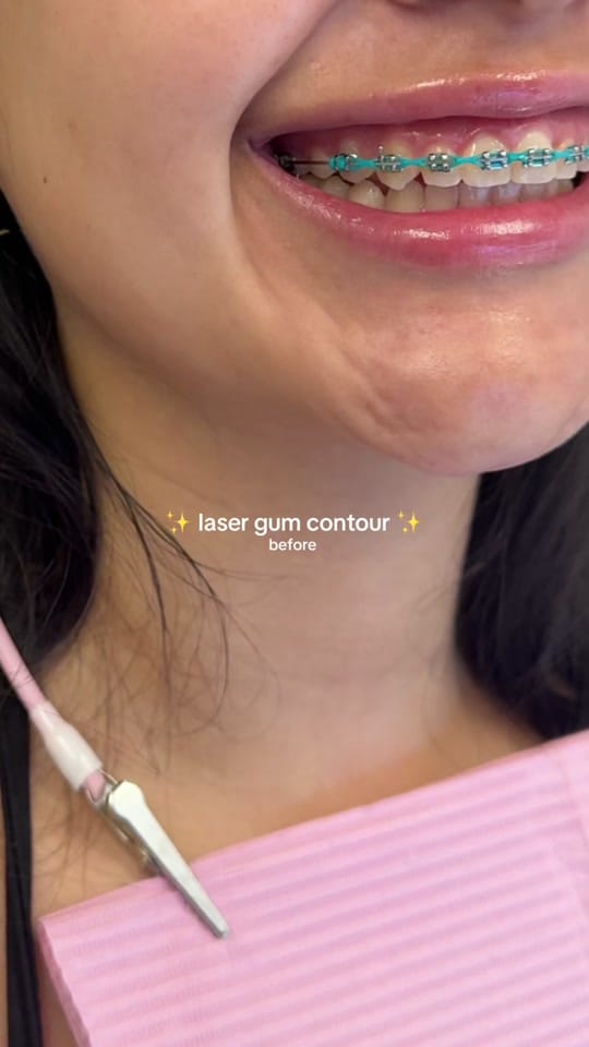 Post 3 by Dr. Tasneem - Gloss Dentistry on TikTok (video)