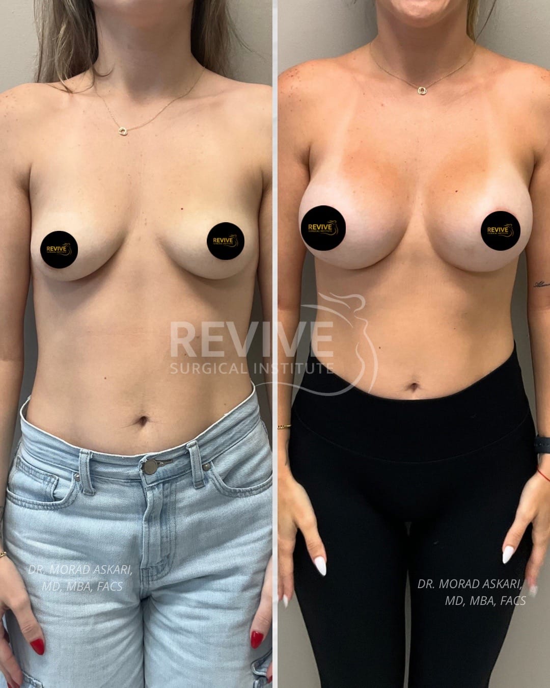 Post 9 by Revive Surgical Institute on TikTok (video)