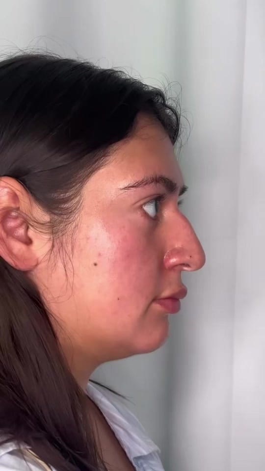 Post 5 by BELLA MEDSPA on TikTok (video)