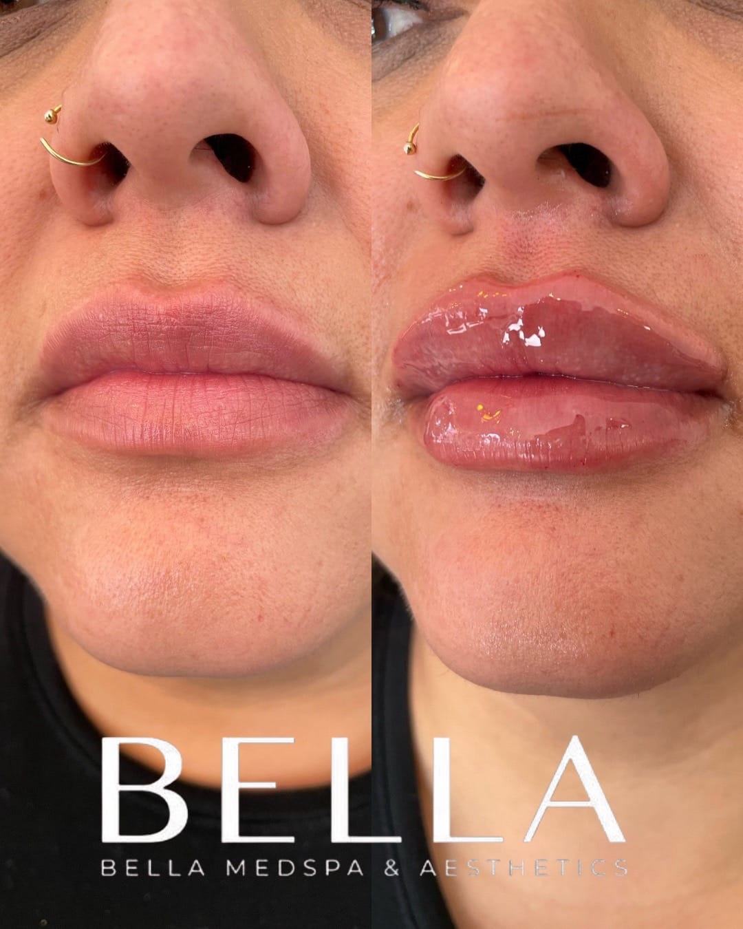 Post 1 by BELLA MEDSPA on TikTok (video)
