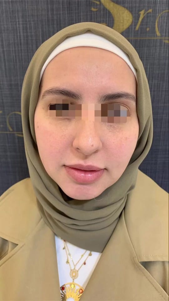 Post 1 by Dr. Ghinwa Kalkas on TikTok (video)
