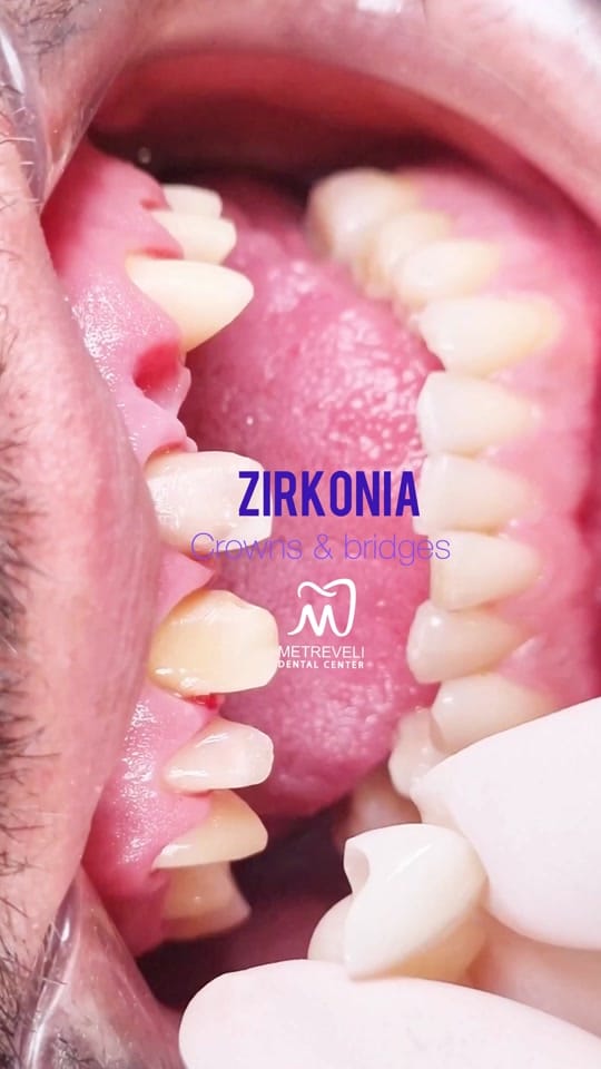 Post 6 by Anna Metreveli Dental Center on TikTok (video)