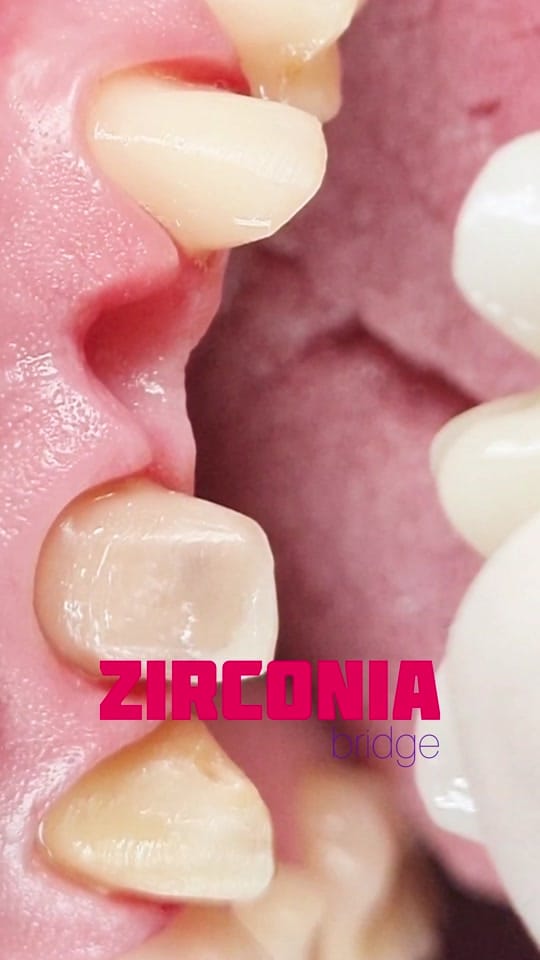 Post 7 by Anna Metreveli Dental Center on TikTok (video)