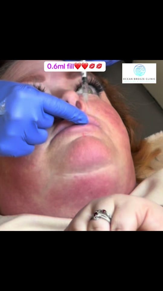 Post 3 by oceanbreezeclinic on TikTok (video)