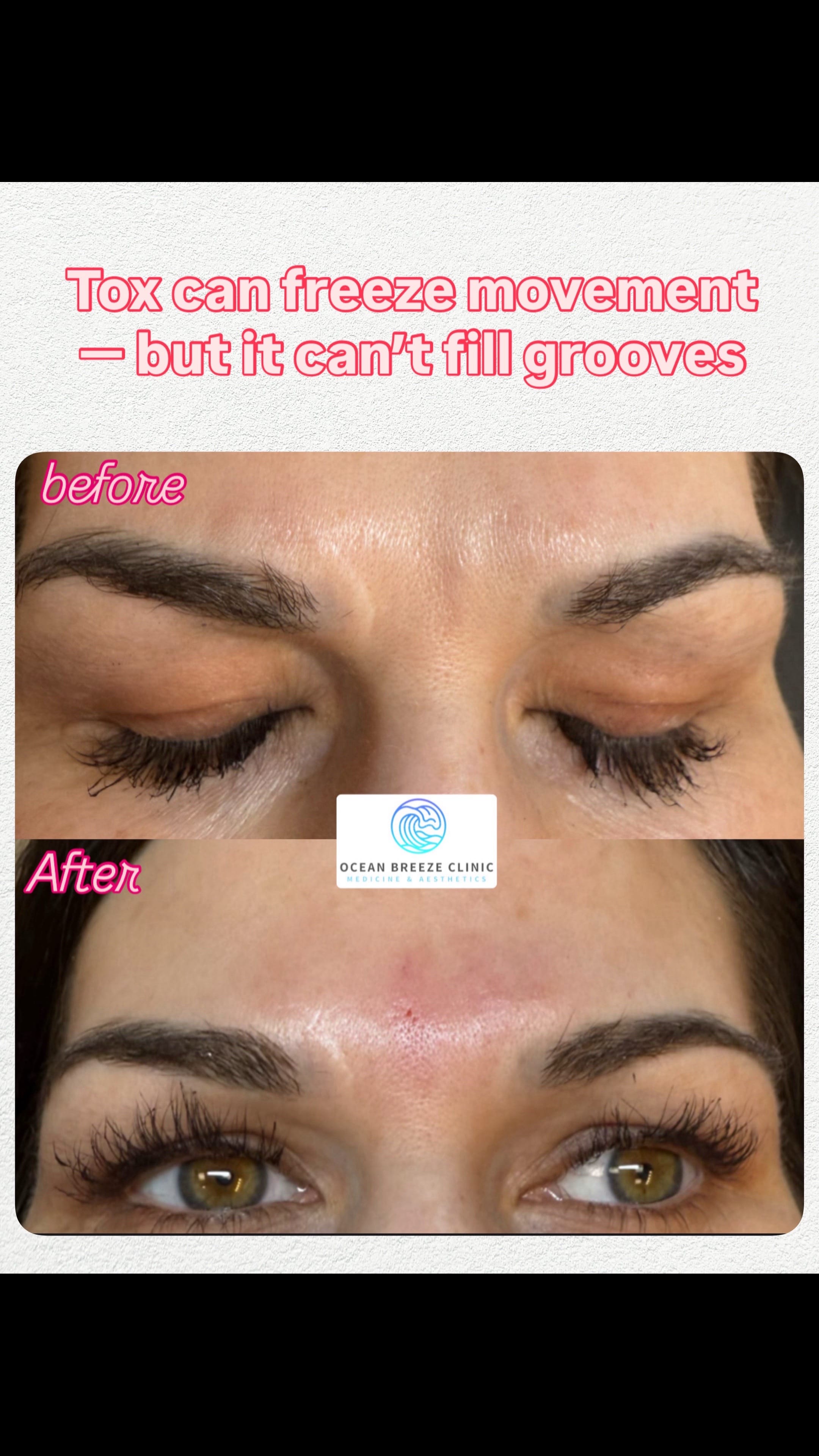 Post 6 by oceanbreezeclinic on TikTok (video)