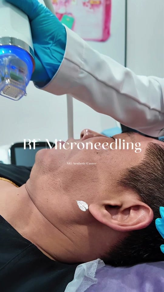 Post 7 by MG Aesthetic Center on TikTok (video)