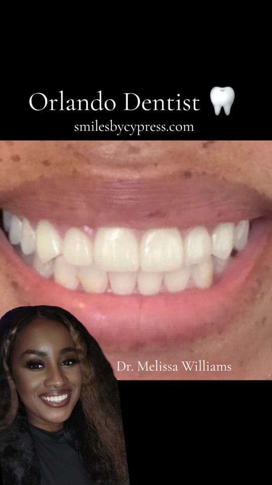 Post 10 by Dr. Williams DMD 🦷 on TikTok (video)