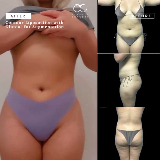 Post 9 by OliverChangMD|Plastic Surgeon on TikTok (video)