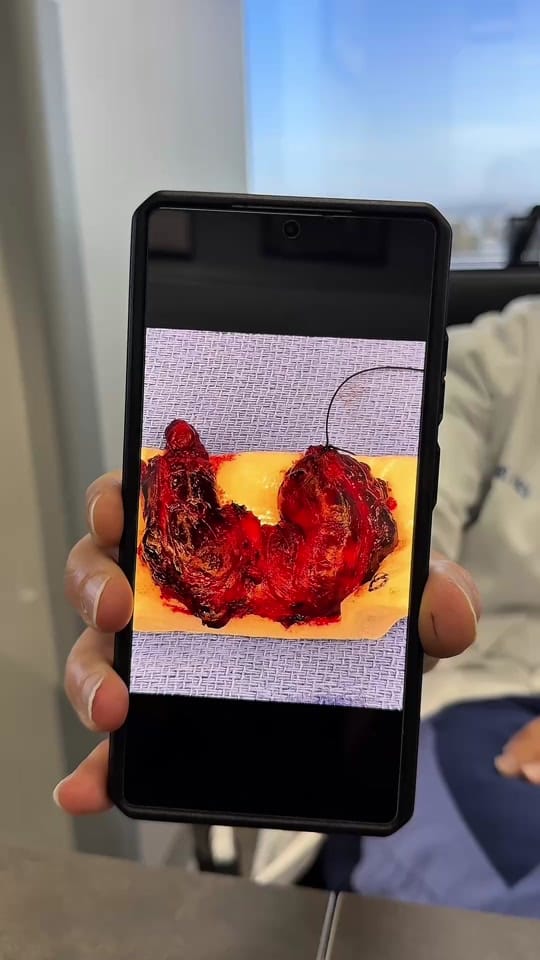 Post 3 by Grossanatomypodcast on TikTok (video)