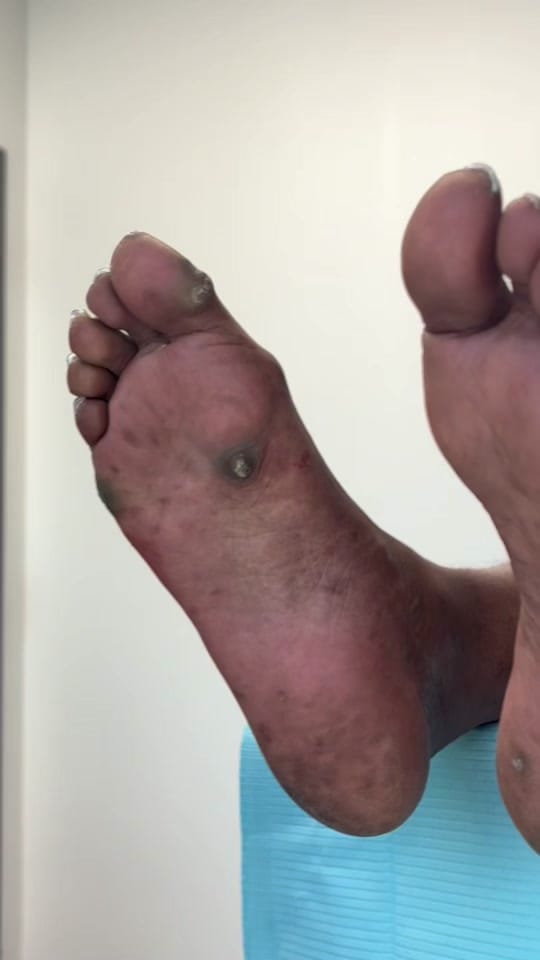 Post 4 by Dr J. Shipp, Podiatry on TikTok (video)