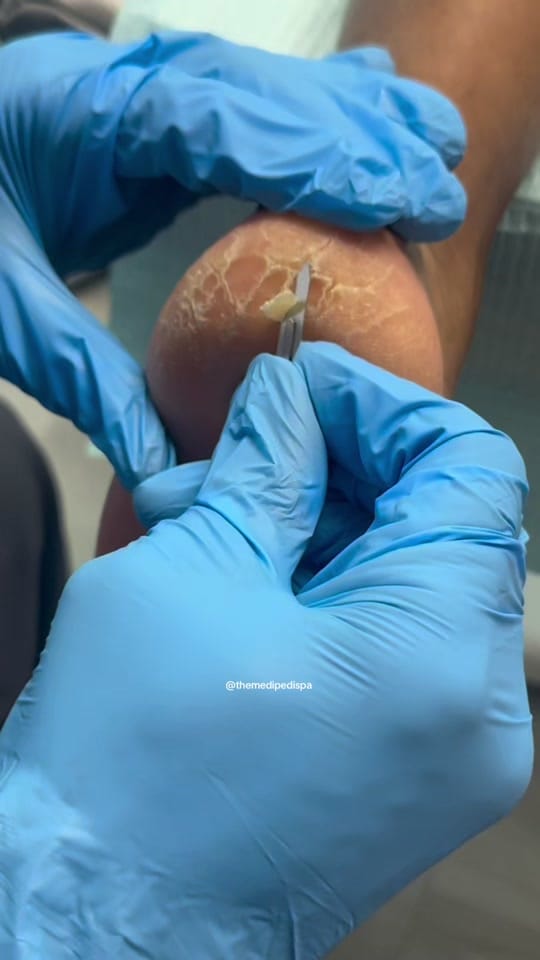 Post 5 by Dr J. Shipp, Podiatry on TikTok (video)
