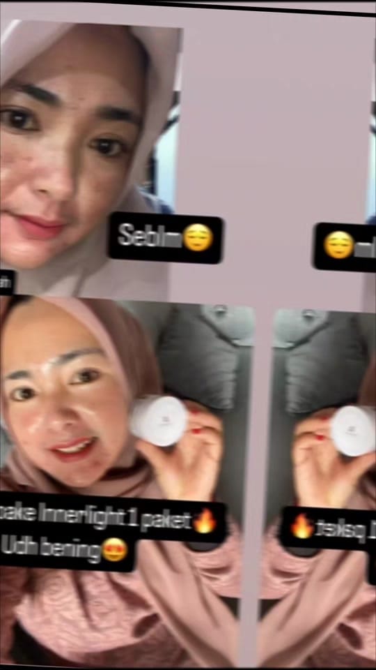 Post 10 by pusatkecantikanbandung on TikTok (video)