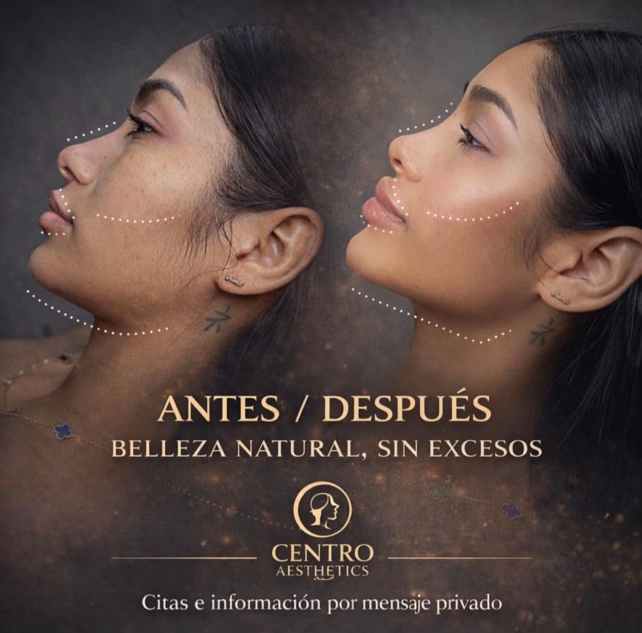 Post 8 by Centro_aesthetic_srm on TikTok (video)