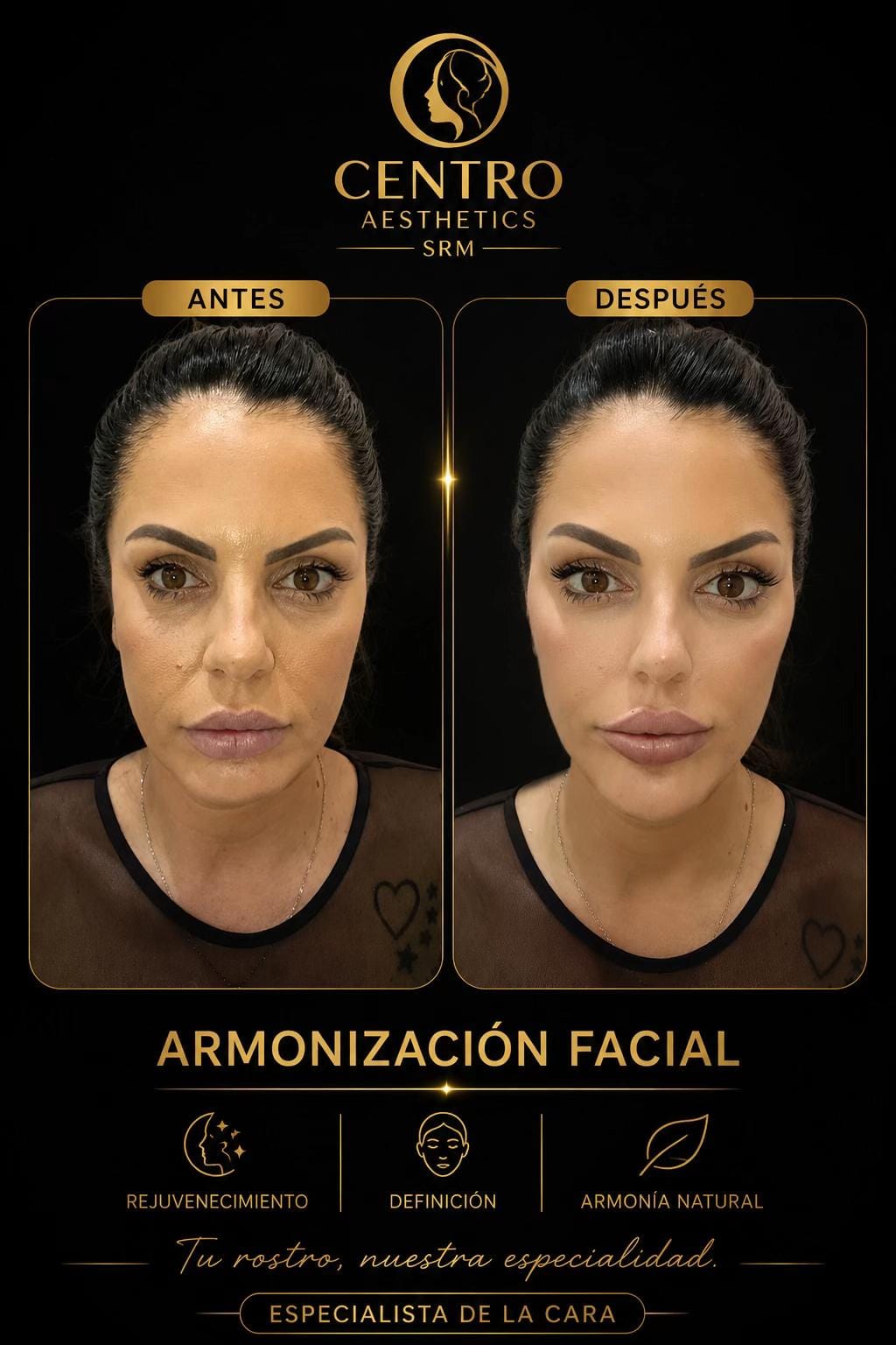 Post 2 by Centro_aesthetic_srm on TikTok (video)