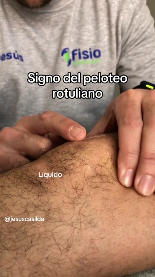 Post 10 by Jesús Casilda on TikTok (video)