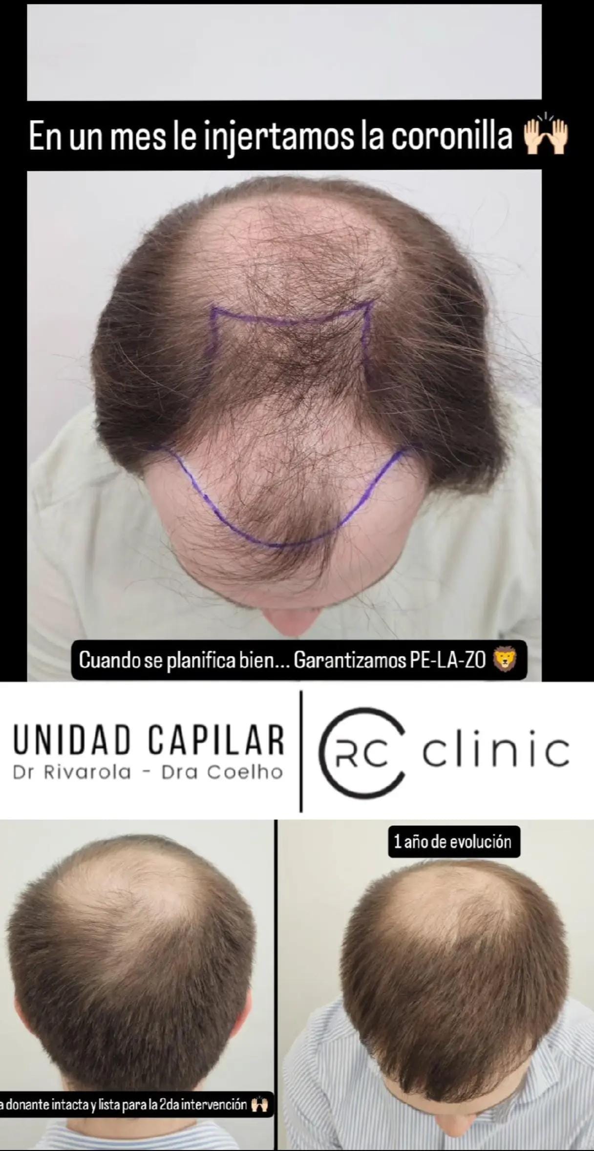 Post 1 by Dr Cristian Rivarola on TikTok (video)