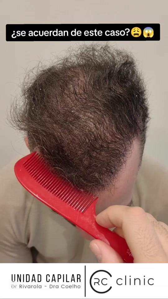 Post 8 by Dr Cristian Rivarola on TikTok (video)
